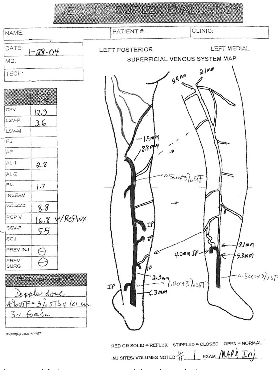 Management Of Venous Malformations In Klippel Trenaunay Syndrome With Ultrasound Guided Foam Sclerotherapy Semantic Scholar DVT Ultrasound Made Easy Step By Step Guide POCUS 101